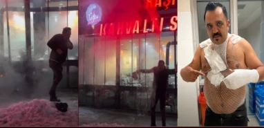 Şov yapmak isterken kendini yaktı