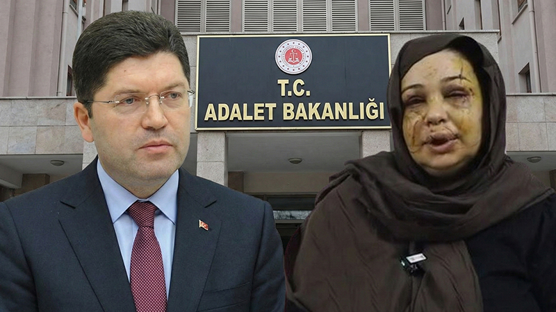 Şanlıurfalı Kadına Şiddet Olayında Yeni Gelişme