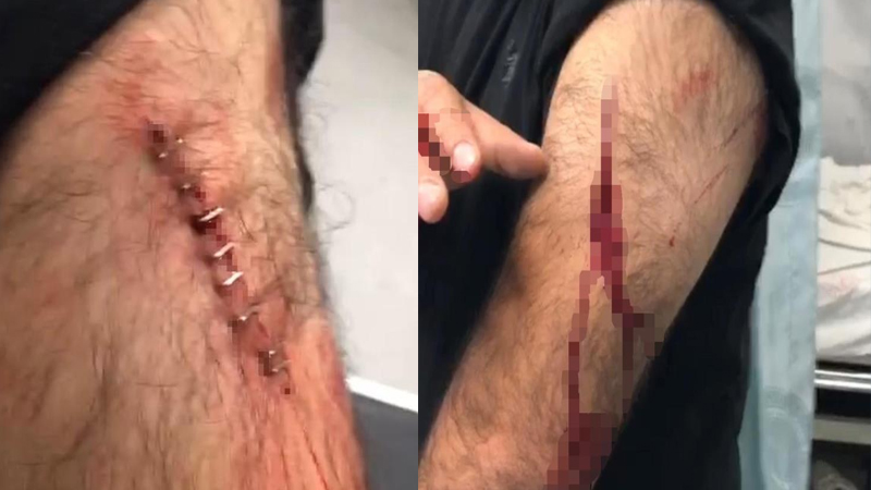 Şanlıurfa’da öğretmene jiletli saldırı!