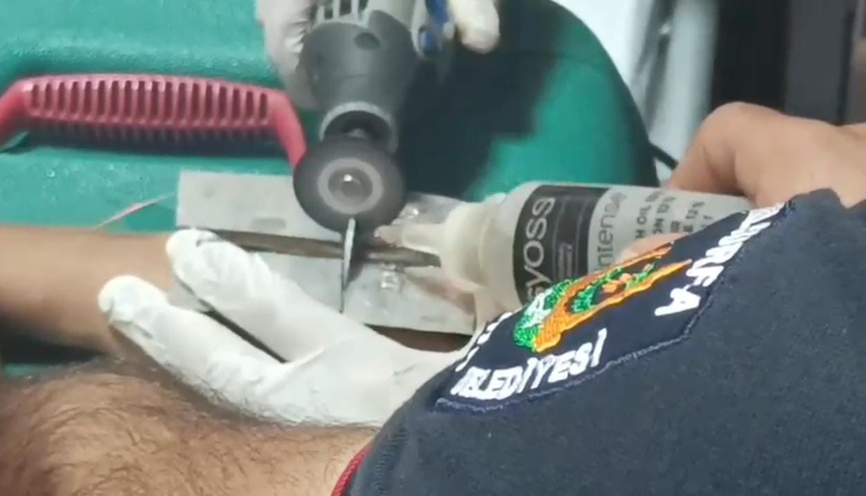 Şanlıurfa’da çocuğun parmağına cıvata pulu sıkıştı