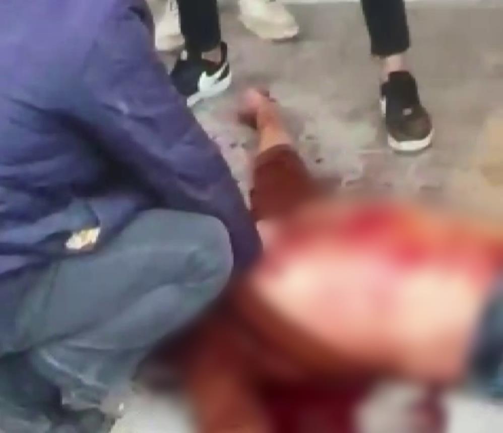 Çocuk Tartışması Silahlı Kavgaya Dönüştü: 1 Ölü, 2 Yaralı