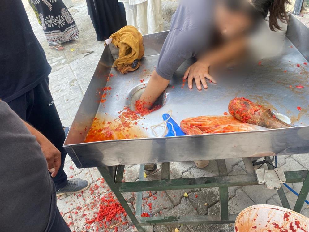 Urfa’da 16 Yaşındaki Kızın Eli Salça Makinesine Sıkıştı