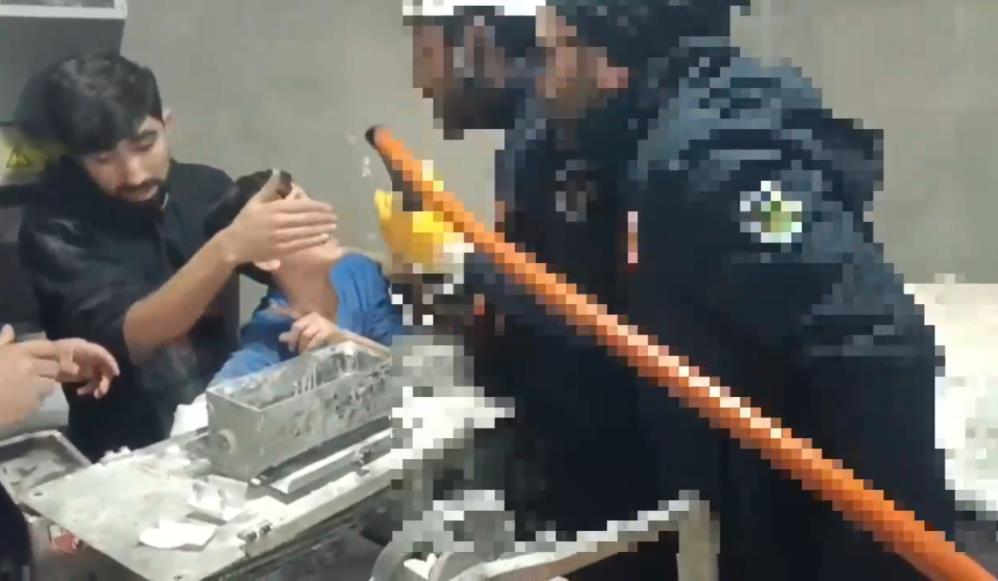 Şanlıurfa’da Hamur Makinesine Sıkışan Çocuk Kurtarıldı