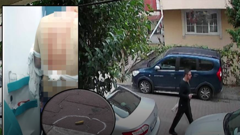 Abisini Zıbkınla Yaraladı Silahla Öldürdü!