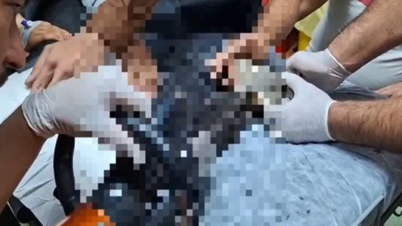 Elini kıyma makinesine kaptıran çocuk Şanlıurfa’da tedavi altına alındı