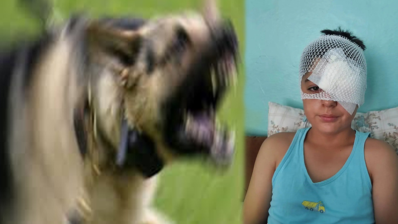 Şanlıurfa’da köpek saldırısından kaçan çocuğa otomobil çarptı