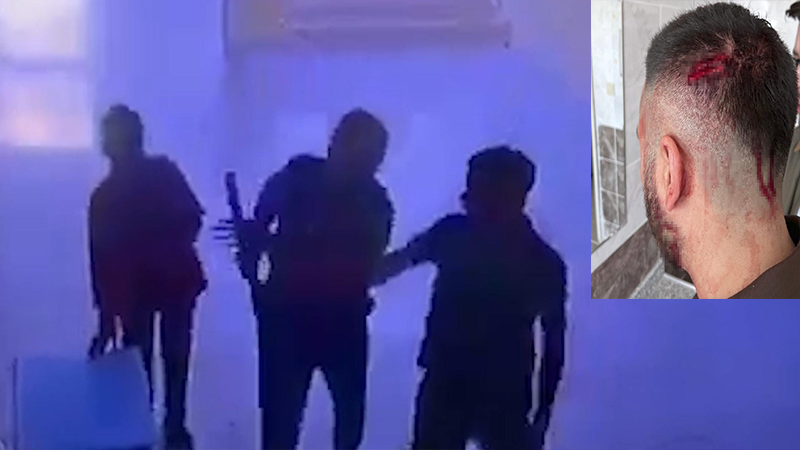 Şanlıurfa'da Öğretmene Darp!