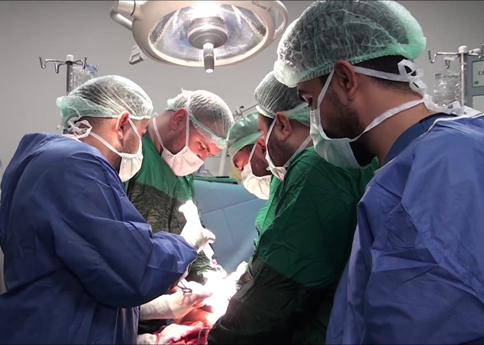 Şanlıurfa’da Tıp Başarısı: 25 Santimetrelik Kist Alındı